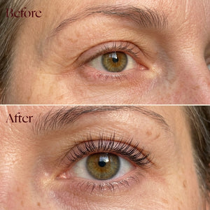 Eyelash Serum